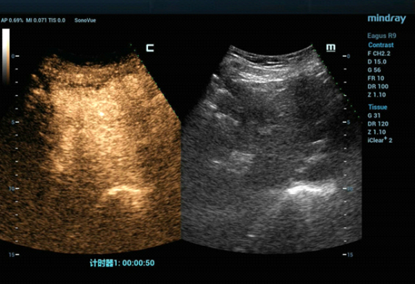 fusion-imaging-fig3