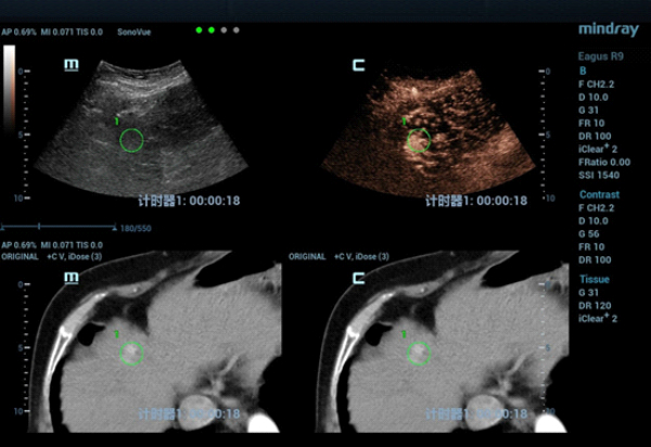 fusion-imaging-fig5