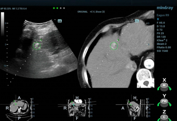 fusion-imaging-fig6