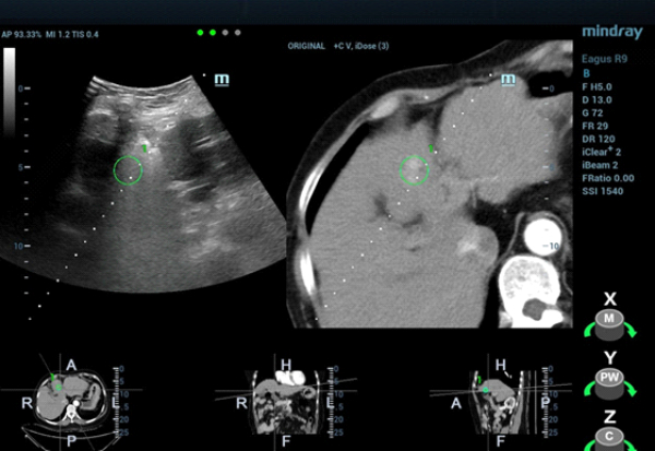 fusion-imaging-fig7