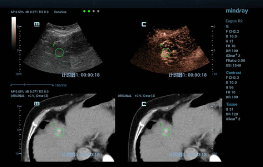 fusion-imaging-kv-pc