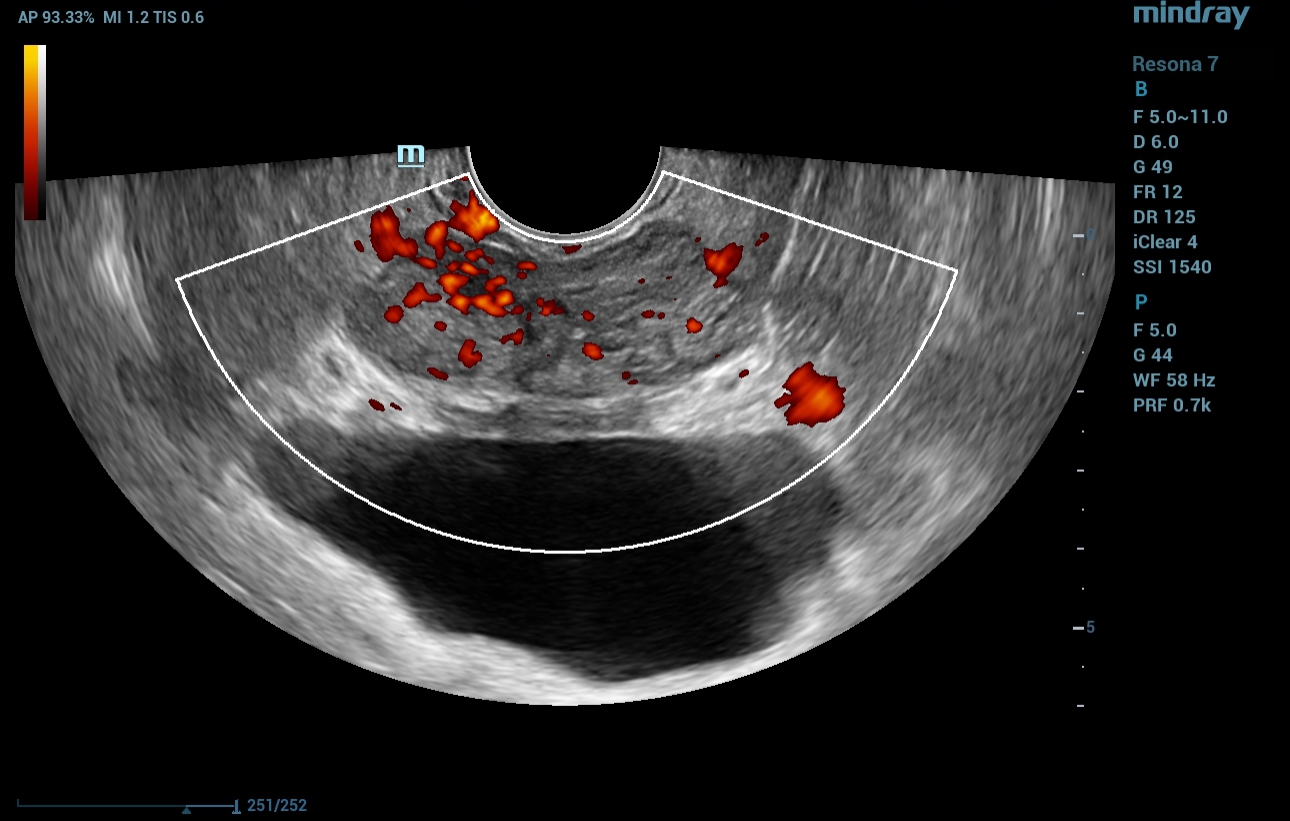 multiparametric-ultrasound-fig2-pc