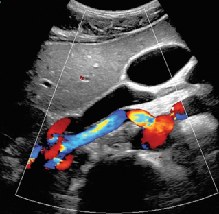 ZONE Sonography Technology