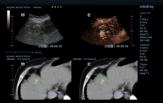 Ultrasound Journal 1: Mindray 